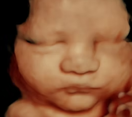Visage d'un bébé découvert lors d'une échographie 3D